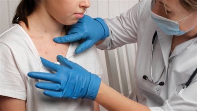 الحصبة تهدد ملايين الأمريكيين.. كل ما تريد معرفته عن المرض وطرق الوقاية منه