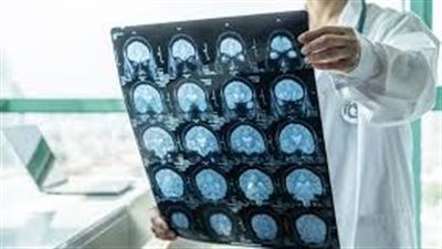 دراسة طبية .. الرنين المغناطيسي ينذر بالسكتة القلبية